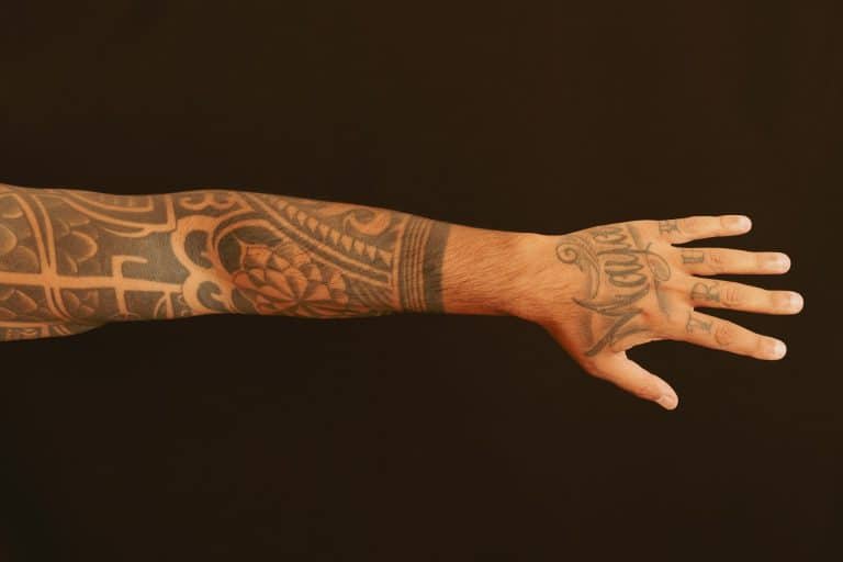 Tattoo Removal